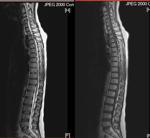 頸、胸、腰全脊椎磁振造影掃描示意圖