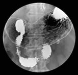 上胃腸道攝影檢查介紹