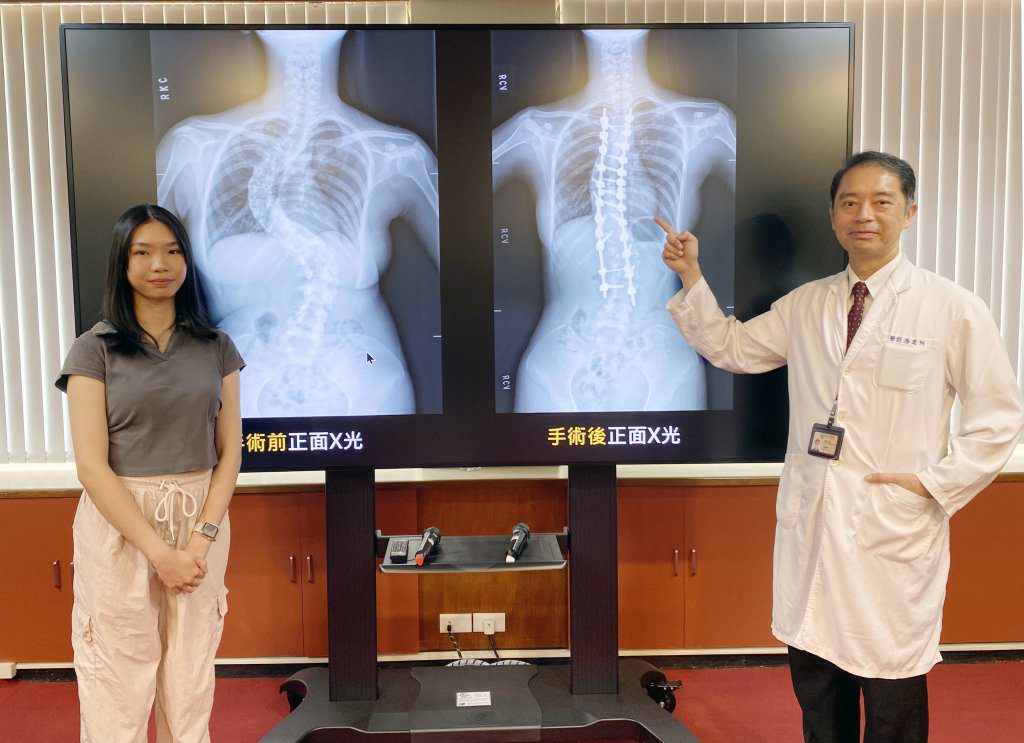 中榮脊椎機械手臂神救援