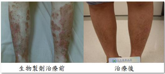 治療前後圖