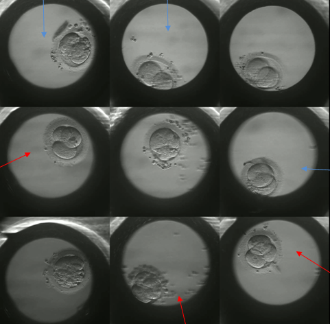 Embryo at Day 2 (red arrow pointing to 3 cells which are abnormal; blue arrow pointing to the two cells developing normally)