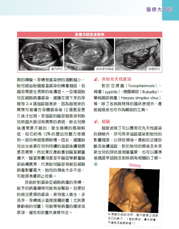 產前超音波在先天性感染扮演的角色