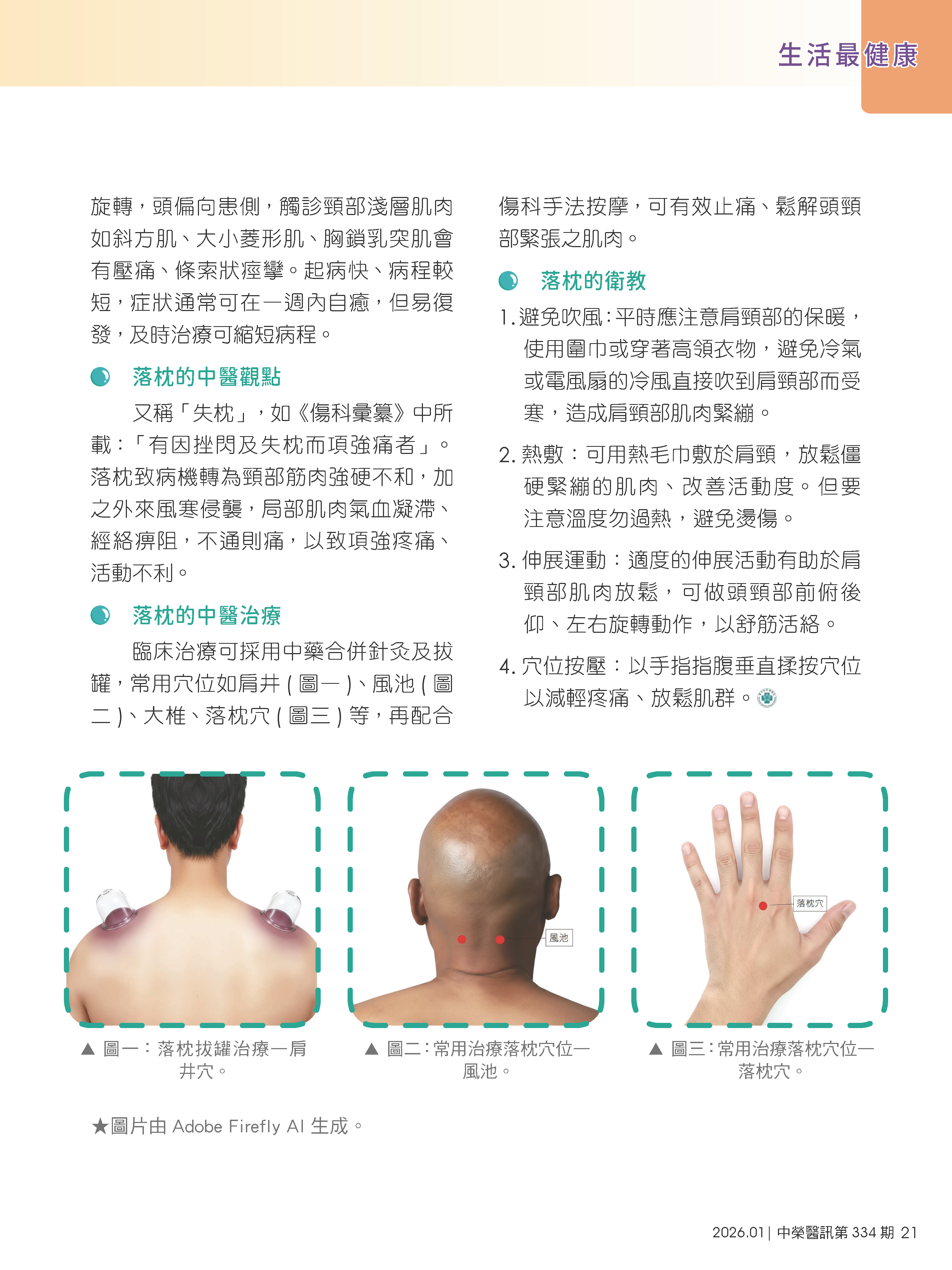 脖子痛又轉不動之落枕中醫治療