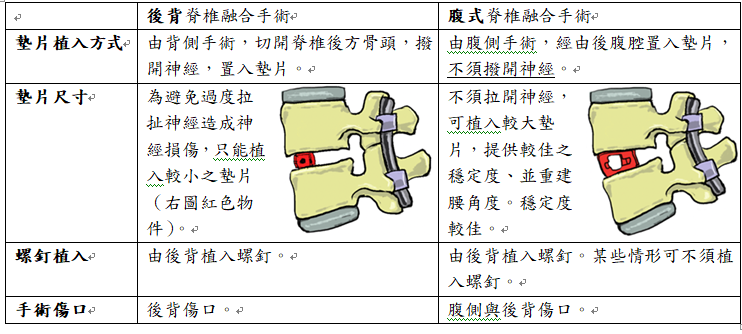 脊椎融合手術