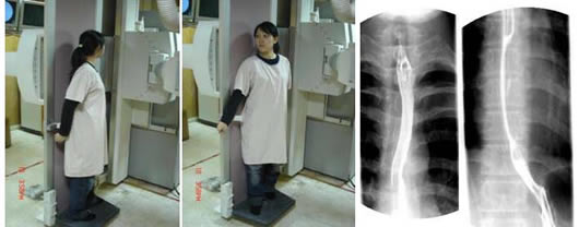 上胃腸道攝影檢查介紹