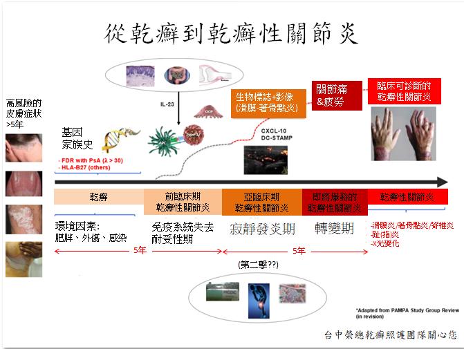 從「乾癬」到「乾癬性關節炎」