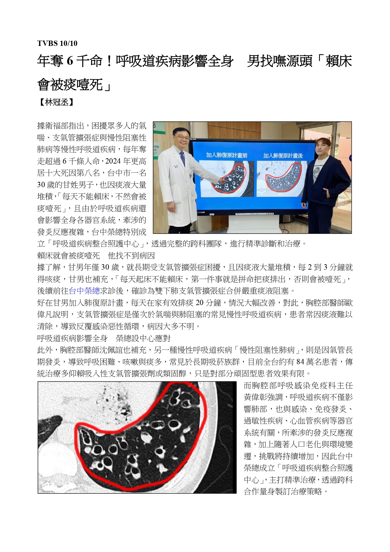 臺中榮總成立「呼吸道疾病整合照護中心」 順暢每一口呼吸