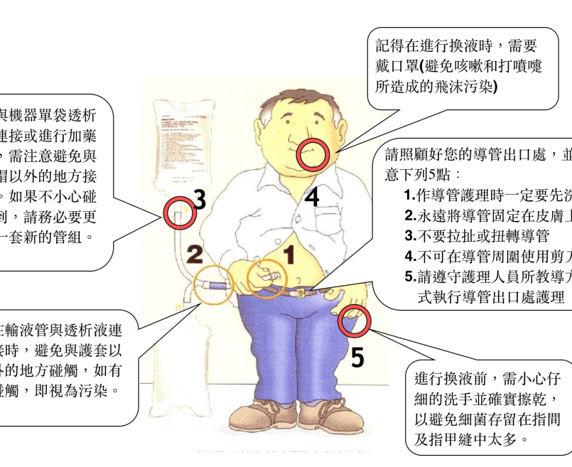 腹膜透析qa 臺中榮總全球資訊網taichung Veterans General Hospital