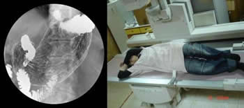 上胃腸道攝影檢查介紹