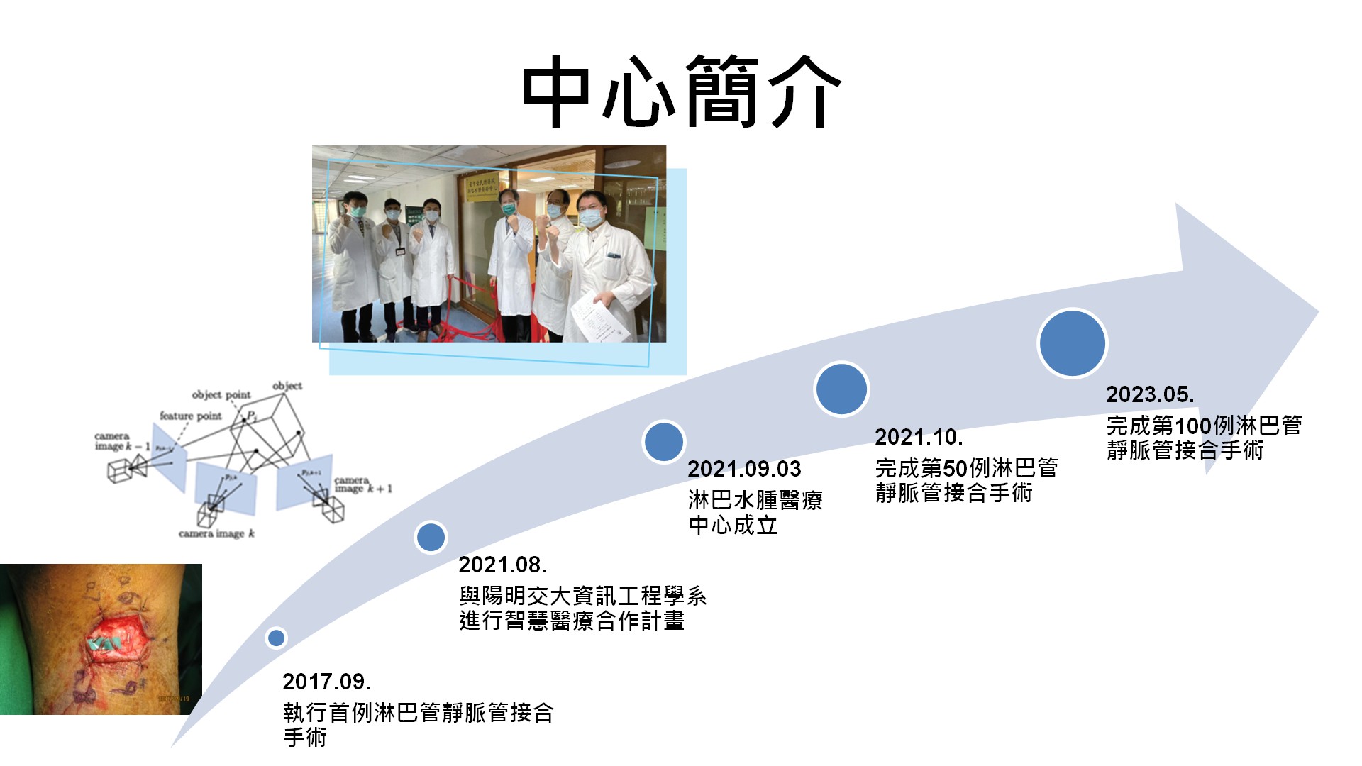 淋巴水腫