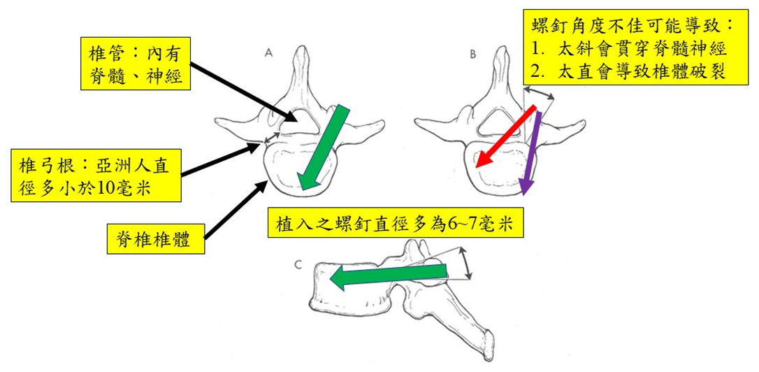 雷納生機械手臂導航手術-1