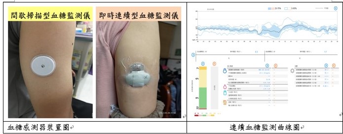 CGM