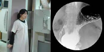 上胃腸道攝影檢查介紹