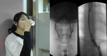 上胃腸道攝影檢查介紹