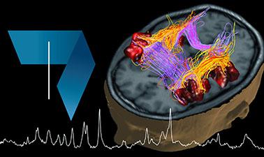 Fundamentals of Biomedical Imaging: Magnetic Resonance Imaging (MRI) Learn about magnetic resonance, from the physical principles of Nuclear Magnetic Resonance (NMR) to the basic concepts of image reconstruction (MRI).