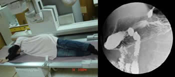 上胃腸道攝影檢查介紹