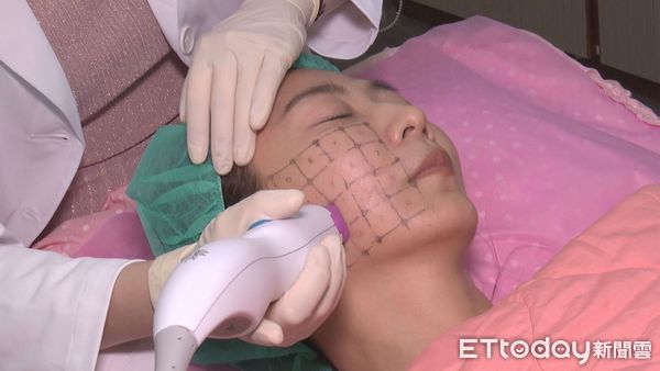 電音波療程太多眼花瞭亂? 醫師教你選出最適合自己的療程