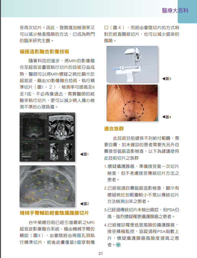 影像機械手臂超音波