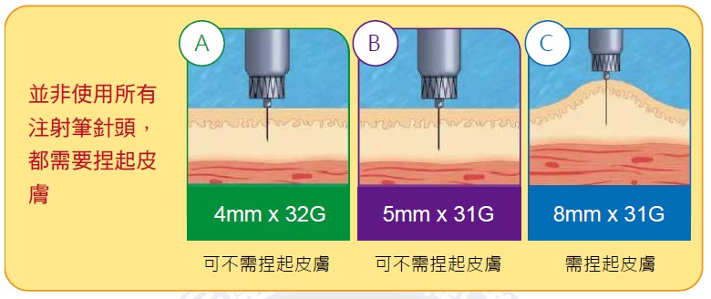 針頭長度與捏起皮膚示意圖