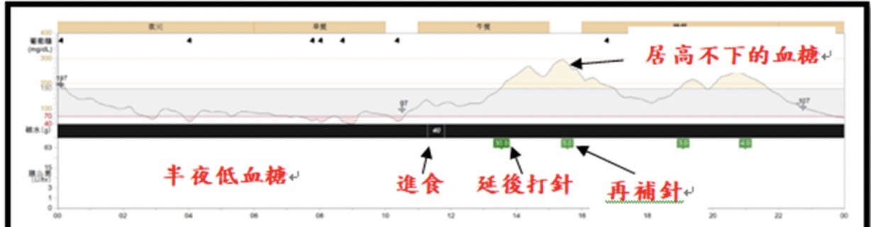 連續血糖監測圖表