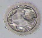 囊胚(取卵後第5,6天)