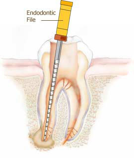 牙髓病科醫療團隊之概況 (Introduction of endodontic section)