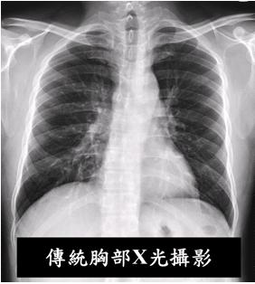 胸部電腦斷層掃描
