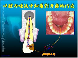 防止唾液中內含細菌的感染