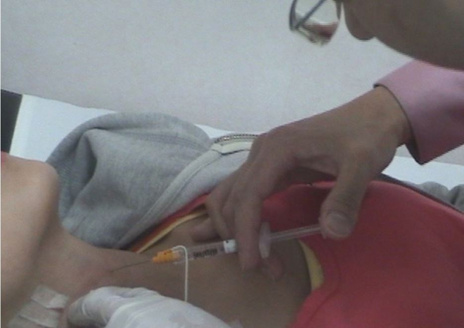圖13 王仲祺主任醫師執行喉肌電針導引玻尿酸注射治療單側聲帶麻痹