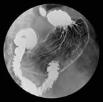 上胃腸道攝影檢查介紹