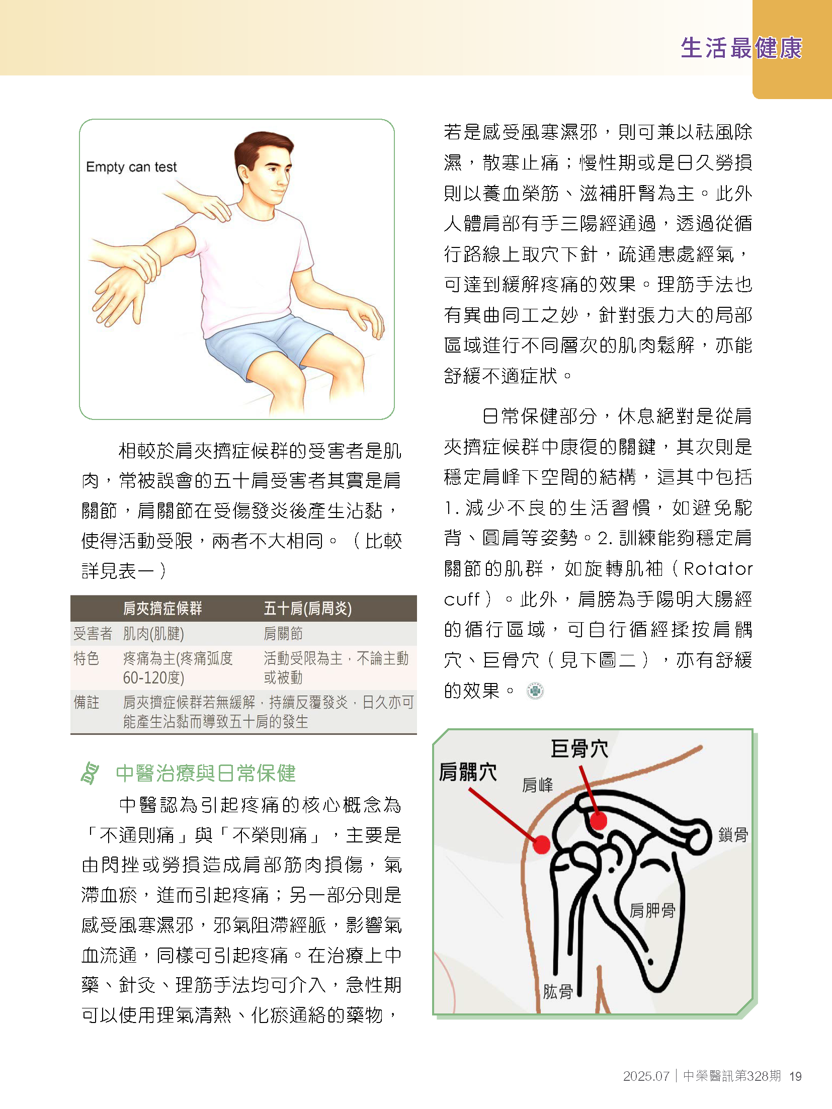 什麼是肩夾擠症候群？